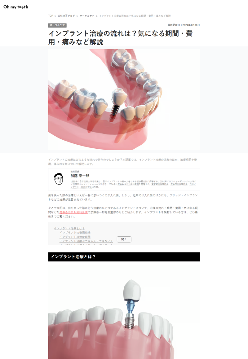 インプラント治療の流れは？気になる期間・費用・痛みなど解説